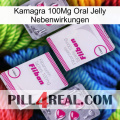 Kamagra 100Mg Oral Jelly Side Effects 33